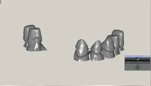 CAD/CAM tervezés a Zirkonzahn programban (1/23)