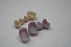 Speciality: a heavily discoloured dentition
