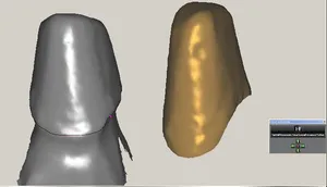 CAD/CAM tervezés a Zirkonzahn programban (2/23)