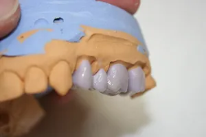 Speciality: a heavily discoloured dentition