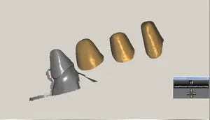 CAD/CAM tervezés a Zirkonzahn programban (3/23)