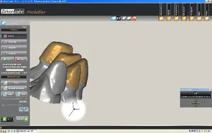 CAD/CAM tervezés a Zirkonzahn programban (4/23)