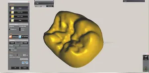 CAD/CAM tervezés a Zirkonzahn programban (14/23)