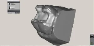 CAD/CAM tervezés a Zirkonzahn programban (17/23)