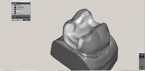 CAD/CAM tervezés a Zirkonzahn programban (18/23)