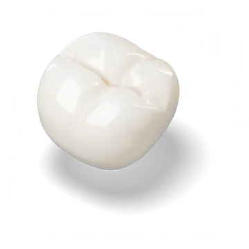 Porcelánnal leplezett őrlőfog-korona